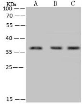 Western Blot: RPRD1B Antibody [NBP3-12539]