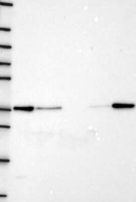 Western Blot: RPRD1B Antibody [NBP3-17643]