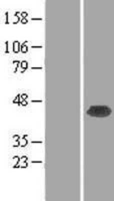 Western Blot: RPRD1B Overexpression Lysate [NBL1-08380]
