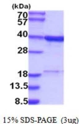 SDS-PAGE: Recombinant Human RPRD1B His Protein [NBP2-52051]