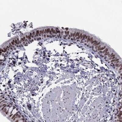 Immunohistochemistry-Paraffin: RPRD2 Antibody [NBP2-56292]