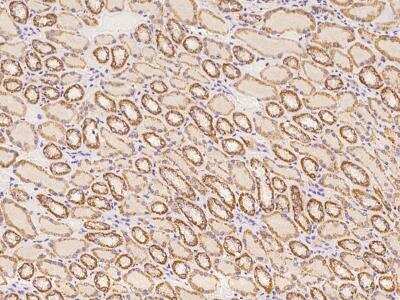 Immunohistochemistry-Paraffin: RPRML Antibody [NBP3-06313]