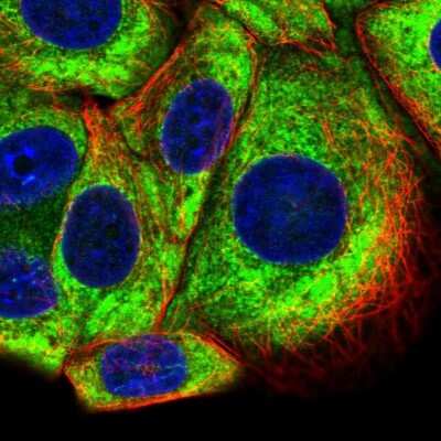 Immunocytochemistry/ Immunofluorescence: RPS10 Antibody [NBP2-47296]