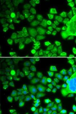 Immunocytochemistry/ Immunofluorescence: RPS10 Antibody - BSA Free [NBP2-93690]