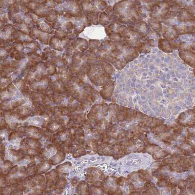 Immunohistochemistry-Paraffin: RPS10 Antibody [NBP2-47296]