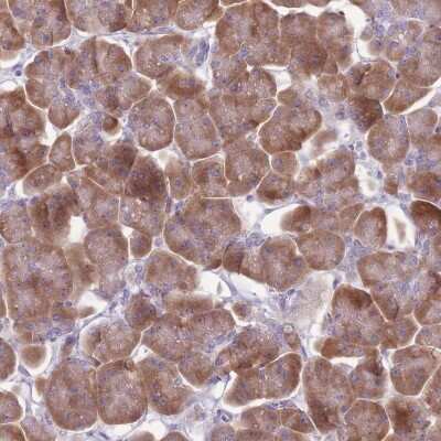 Immunohistochemistry-Paraffin: RPS11 Antibody [NBP2-13262]