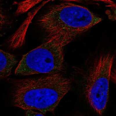 Immunocytochemistry/ Immunofluorescence: RPS12 Antibody [NBP2-58885]