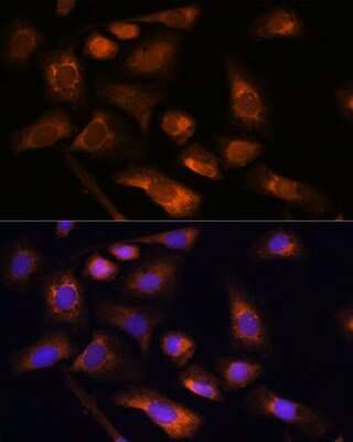 Immunocytochemistry/ Immunofluorescence: RPS13 Antibody - Azide and BSA Free [NBP2-93953]