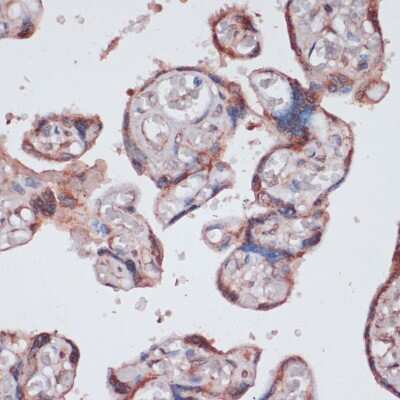 Immunohistochemistry-Paraffin: RPS13 Antibody - Azide and BSA Free [NBP2-93953]
