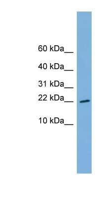 Western Blot: RPS13 Antibody [NBP1-53188]