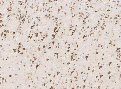 Immunohistochemistry-Paraffin: RPS14 Antibody [NBP3-12555]