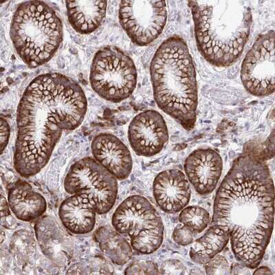 Immunohistochemistry-Paraffin: RPS15 Antibody [NBP2-34083]