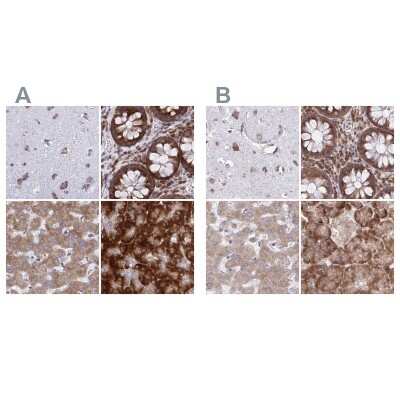 Immunohistochemistry-Paraffin: RPS15 Antibody [NBP2-34083]