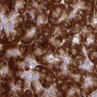 Immunohistochemistry-Paraffin: RPS15 Antibody [NBP2-34083]