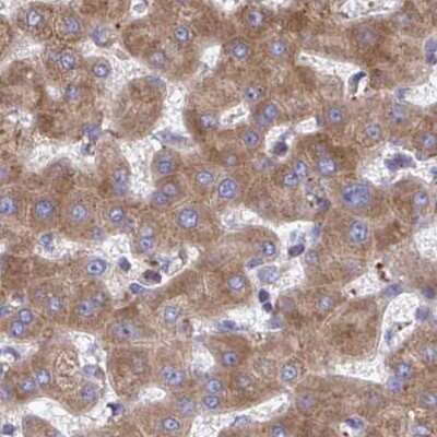 Immunohistochemistry-Paraffin: RPS15 Antibody [NBP2-34083]
