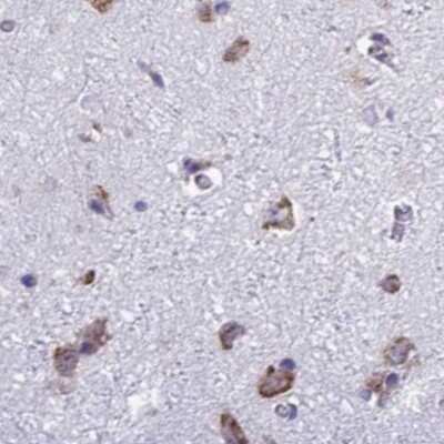 Immunohistochemistry-Paraffin: RPS15 Antibody [NBP2-34083]