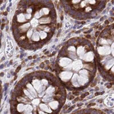 Immunohistochemistry-Paraffin: RPS15 Antibody [NBP2-34083]