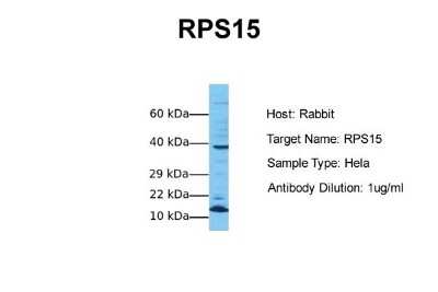 Western Blot: RPS15 Antibody [NBP1-55205]