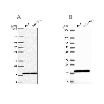 Western Blot: RPS15 Antibody [NBP2-33717]
