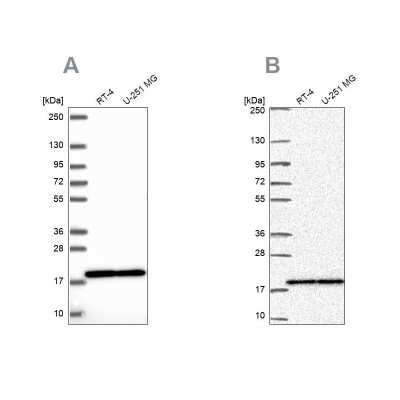 Western Blot: RPS15 Antibody [NBP2-34083]