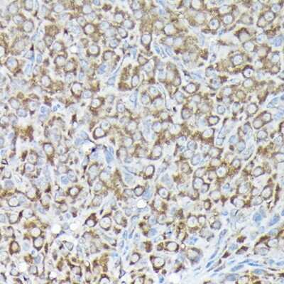 Immunohistochemistry-Paraffin: RPS15A Antibody - BSA Free [NBP2-93348]