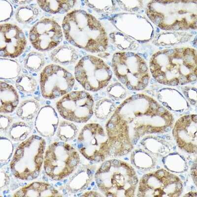 Immunohistochemistry-Paraffin: RPS15A Antibody - BSA Free [NBP2-93348]