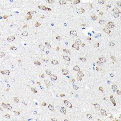 Immunohistochemistry-Paraffin: RPS15A Antibody - BSA Free [NBP2-93348]