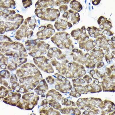 Immunohistochemistry-Paraffin: RPS15A Antibody - BSA Free [NBP2-93348]