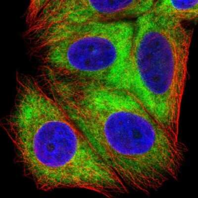 Immunocytochemistry/ Immunofluorescence: RPS16 Antibody [NBP2-32384]