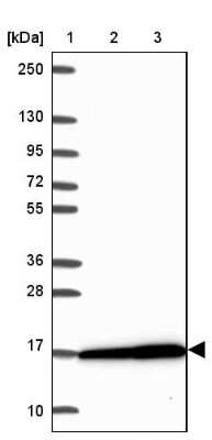 Western Blot: RPS16 Antibody [NBP2-32384]