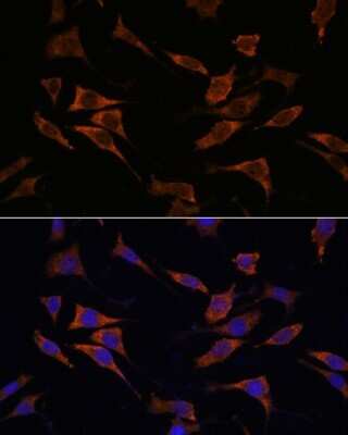 Immunocytochemistry/ Immunofluorescence: RPS17 Antibody - Azide and BSA Free [NBP2-93721]