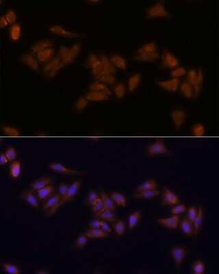 Immunocytochemistry/ Immunofluorescence: RPS17 Antibody - Azide and BSA Free [NBP2-93721]