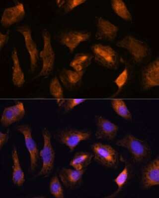 Immunocytochemistry/ Immunofluorescence: RPS17 Antibody - Azide and BSA Free [NBP2-93721]