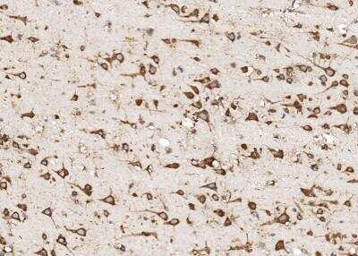 Immunohistochemistry-Paraffin: RPS17 Antibody [NBP3-12556]