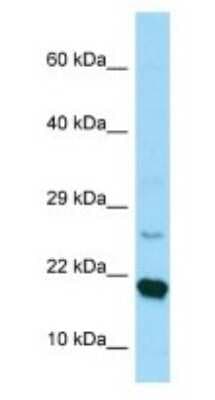Western Blot: RPS17 Antibody [NBP1-98593]