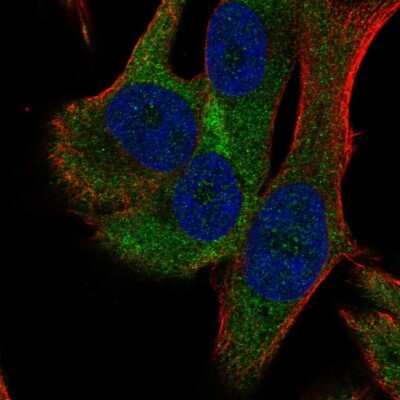 Immunocytochemistry/ Immunofluorescence: RPS18 Antibody [NBP2-55001]