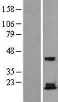 Western Blot: RPS18 Overexpression Lysate [NBL1-15563]