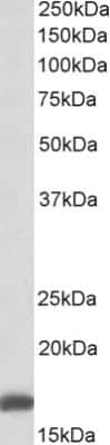 Western Blot: RPS19 Antibody [NB100-2452]