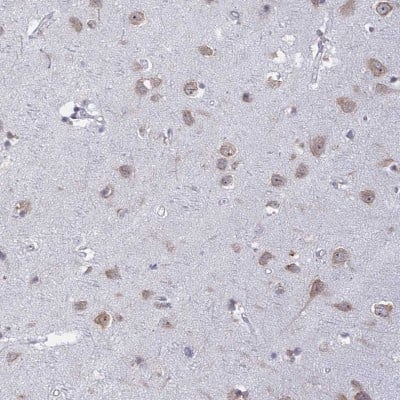 Immunohistochemistry-Paraffin: RPS19BP1 Antibody [NBP1-83617]