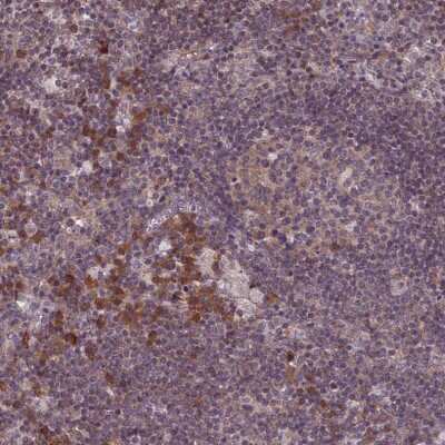 Immunohistochemistry-Paraffin: RPS19BP1 Antibody [NBP1-83617]