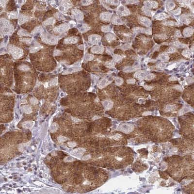 Immunohistochemistry-Paraffin: RPS19BP1 Antibody [NBP1-83617]