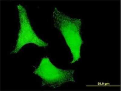 Immunocytochemistry/ Immunofluorescence: RPS2 Antibody (3G6) [H00006187-M01]
