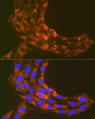 Immunocytochemistry/ Immunofluorescence: RPS20 Antibody (9H1D4) [NBP3-16824]