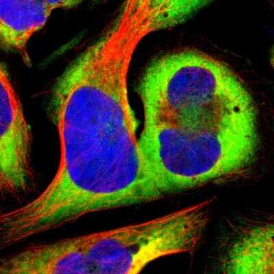 Immunocytochemistry/ Immunofluorescence: RPS20 Antibody [NBP1-80804]