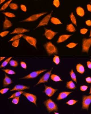 Immunocytochemistry/ Immunofluorescence: RPS20 Antibody - BSA Free [NBP2-93745]