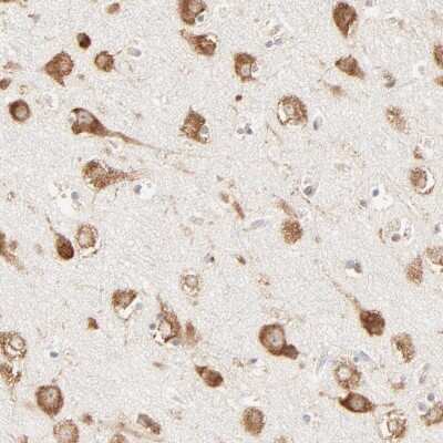 Immunohistochemistry-Paraffin: RPS20 Antibody [NBP1-80804]