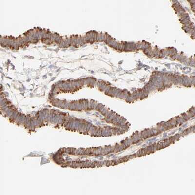 Immunohistochemistry-Paraffin: RPS20 Antibody [NBP1-80804]