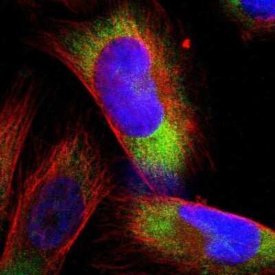 Immunocytochemistry/ Immunofluorescence: RPS21 Antibody [NBP1-87100]