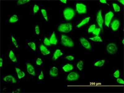 Immunocytochemistry/ Immunofluorescence: RPS23 Antibody (1E3) [H00006228-M02]