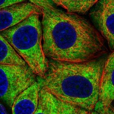 Immunocytochemistry/ Immunofluorescence: RPS23 Antibody [NBP2-30412]